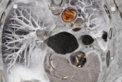 2019 10 07 16 45 2259 Black Blood Ct Aortic Valve 20191007165452