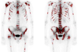 2019 10 08 07 32 7265 A Sbi Image Jnm Anand 20191008072210