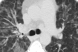 2019 10 09 18 34 3018 Vape 1 Henry 20191009181523