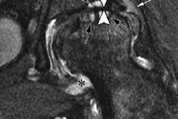 2019 10 14 23 06 9324 2019 10 15 Osteoarthritis Kompel 20191015000144