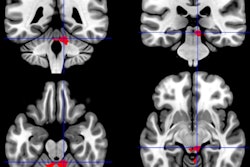 2019 10 23 17 27 3345 2019 10 23 Fmri Vets 400
