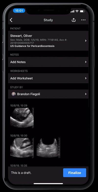 View of Butterfly Enterprise. Image courtesy of Butterfly Network.