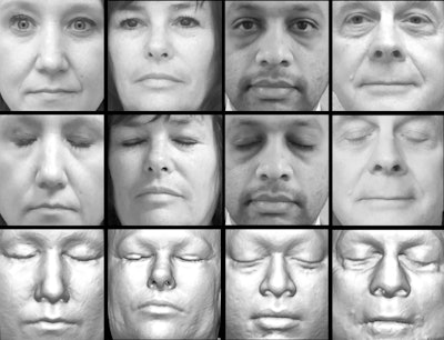 Shown are examples of study participants' photos (top and middle rows) and corresponding facial reconstructions from structural MRI (bottom row). Photos in which the participants' eyes were closed (middle) are shown for visual similarity. Researchers used photos with opened eyes (top) for software-based face recognition. Images courtesy of the New England Journal of Medicine.