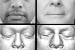 2019 10 25 04 54 3460 2019 10 25 Mri Facial Recognition Schwarz 20191025043230