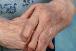 2019 10 30 17 20 8741 Hands Arthritis2 400