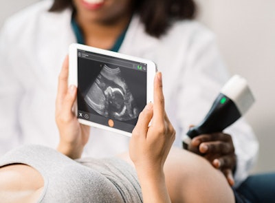 Clarius handheld ultrasound scanner. Image courtesy of Clarius.
