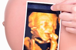 2017 11 07 22 15 5907 Pregnant Ultrasound 400