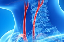 2019 08 15 18 50 4373 Carotid Artery 3 D 400