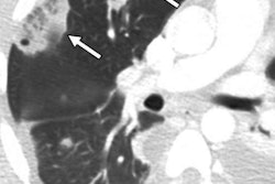 2019 11 01 23 29 1314 2019 11 04 Ct Reversed Halo Thumb