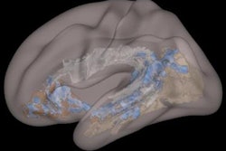 2019 11 05 00 29 8890 2019 11 05 Brain Mri Child Thumb 20191105000729