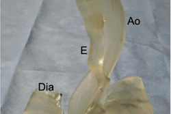 2019 11 06 23 05 0070 2019 11 07 3 D Printed Esophagus 20191106235706