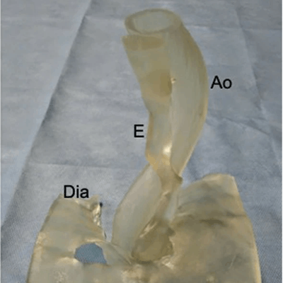 2019 11 06 23 05 0070 2019 11 07 3 D Printed Esophagus 20191106235706