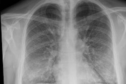 2019 11 11 17 56 8284 X Ray Vaping 20191111171703