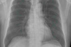 2019 11 12 00 45 6964 2019 11 12 Deep Learning Lung Nodules 20191112005404