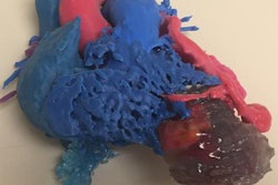 2019 11 13 21 55 5629 2019 11 14 3 D Printed Heart Mri 20191113213455