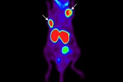 2019 11 15 23 33 3685 2019 11 18 Psma Pet Agent Jnm 400