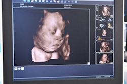 2019 11 20 00 01 9913 Ultrasound 3 D Fetal Head 400