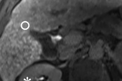 2019 11 20 00 10 1871 2019 11 20 Flis Liver Mri Scores Bastati 400