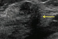 2019 11 26 22 00 6477 2019 11 27 Berg Breast Ultrasound Pic2 400