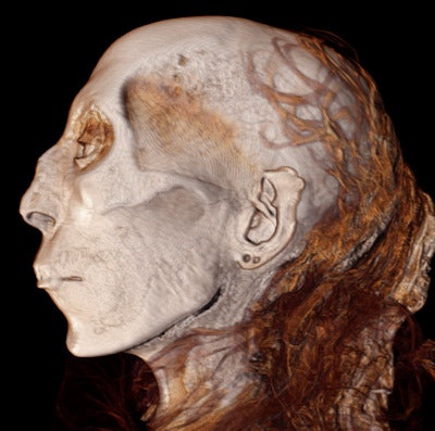 This 3D CT image of the profile of Thuya (great grandmother of Tutankhamun) depicts her facial features, including the two openings in her ear lobe for earrings, which was in vogue at the time. All images courtesy of Dr. Sahar Saleem and Dr. Zahi Hawass.