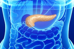 2018 03 06 00 04 4002 Pancreas New 400