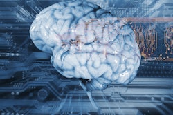 2018 08 10 22 42 4903 Artificial Intelligence Brain 400