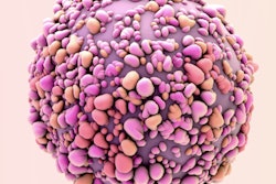 2019 09 18 21 21 9195 Breast Cancer Cell2 400