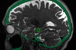 2019 11 27 19 51 8185 2019 12 03 M Rg Fus Alzheimers 400