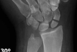 2019 11 27 22 03 3360 2019 12 03 Scooter Fracture 20191127222504