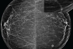 2019 12 01 18 41 7961 Halling Brown Ai Breat Rsna 20191201181911