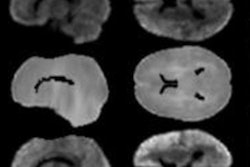 2019 12 02 18 50 3160 Wengler Mri Depression Rsna 400