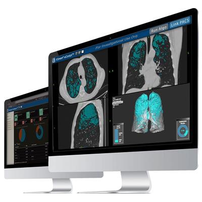 The XStream aiCockpit and XStream aiPlatform. Image courtesy of Fovia Ai.