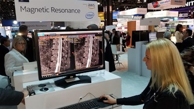 AIR Recon DL applies deep-learning reconstruction to improve the sharpness of MR images.