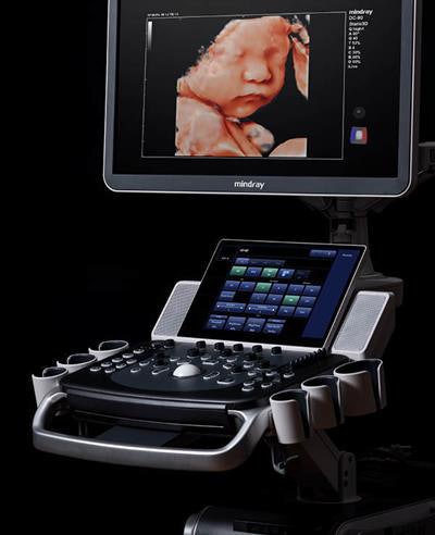 The DC-90 with X-Insight. Image courtesy of Mindray Medical International.