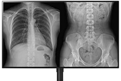 2019 12 04 22 36 1091 Lg Model 32 Hl512 D 400