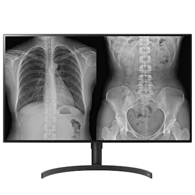 The 31.5-inch, 8-MP model 32HL512D. Image courtesy of LG Electronics USA Business Solutions.