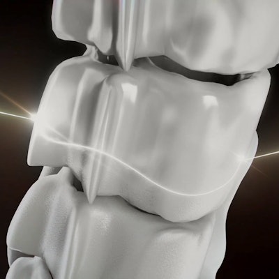 Adam will soon begin clinical trials of two types of low-cost 3D-printed bones. Image courtesy of the Adam Project.