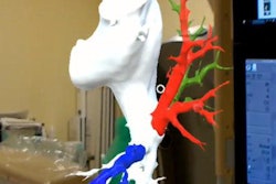 2019 12 05 21 50 0669 Ar Pulmonary Artery 20191205220325