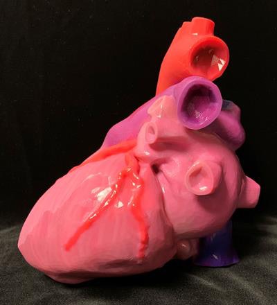 An individually tailored, multicolor 3D-printed heart. Image courtesy of Summer Decker, PhD.