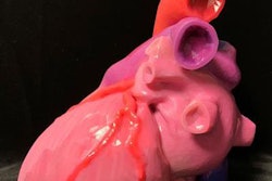 2019 12 19 17 02 3363 2019 12 19 3 D Printed Heart 20191219172335 20191219172445
