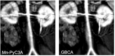 Contrast-enhanced MR image of the abdominal aorta, renal arteries, and kidneys of a baboon acquired with the manganese-based agent Mn-PyC3A (left), compared with the same scan with a gadolinium-based contrast agent (right). Images courtesy of Caravan et al.
