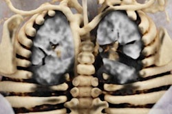 2019 12 24 19 46 9194 Cr Subclavian Artery 20191224191020