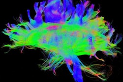 2020 01 03 23 51 2518 2020 01 06 Fmri Pathways 400