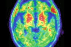 2020 01 03 23 54 0117 2020 01 06 Flortaucipir Pet 400