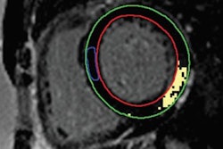 2020 01 06 22 36 5981 2020 01 07 Fabry Disease 20200106223249