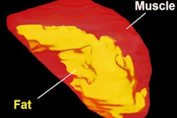 2020 01 09 23 29 2031 2020 01 10 Mri Sleep Apnea Thumb