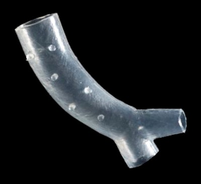 Patient-specific 3D-printed airway stent. Image courtesy of Cleveland Clinic.