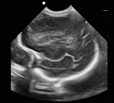 Image courtesy of SonoSim.