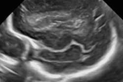2020 01 14 01 52 5912 Sono Sim Ultrasound 20200114013842