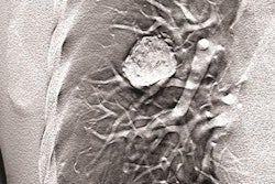 2020 01 14 18 18 4944 Carestream Dt 20200114183606